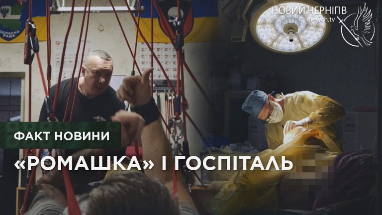 У Чернігівському військовому госпіталі створюють документальний кінопроєкт про людей, яких змінює війна